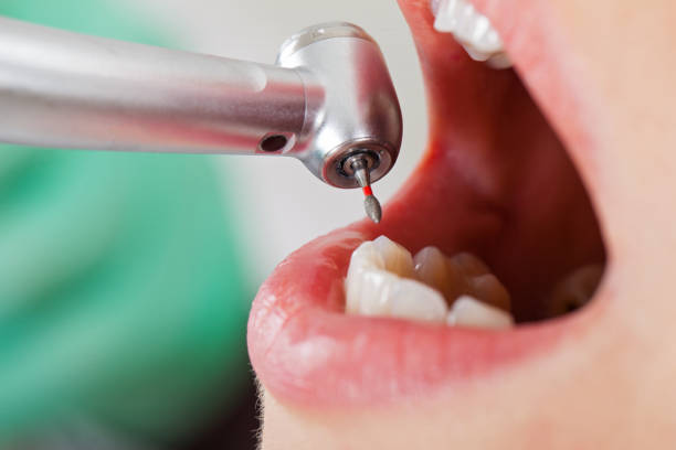 Best Emergency Root Canal Therapy in Marlow Heights, MD